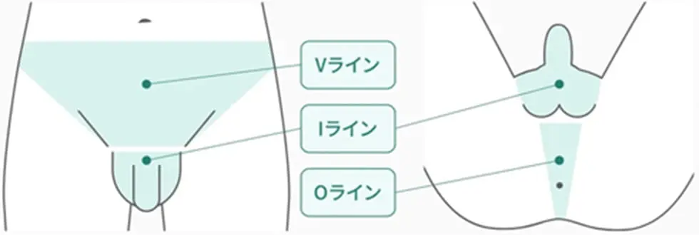 Vライン、Iライン、Oライン