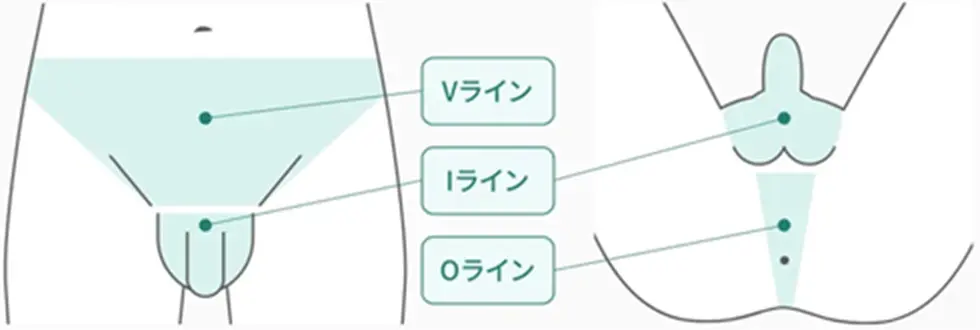 Vライン、Iライン、Oライン